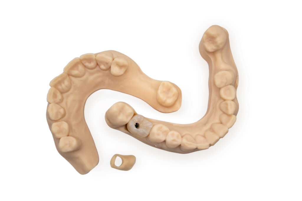 Sistemi-Innovativi-Dentali-Stampa-3D