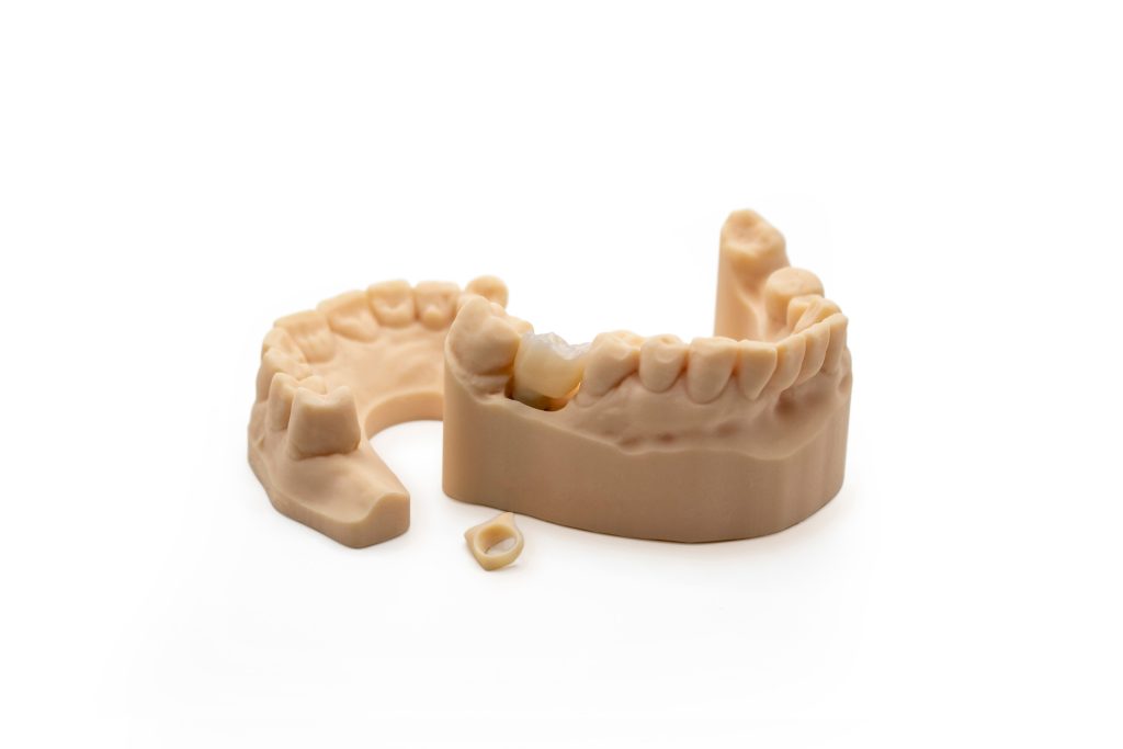 SID Stampa 3D Dentale