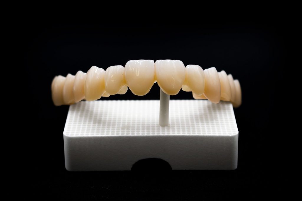 Ponti e corone da Stratificare ed Integrali - Sistemi Innovativi Dentali