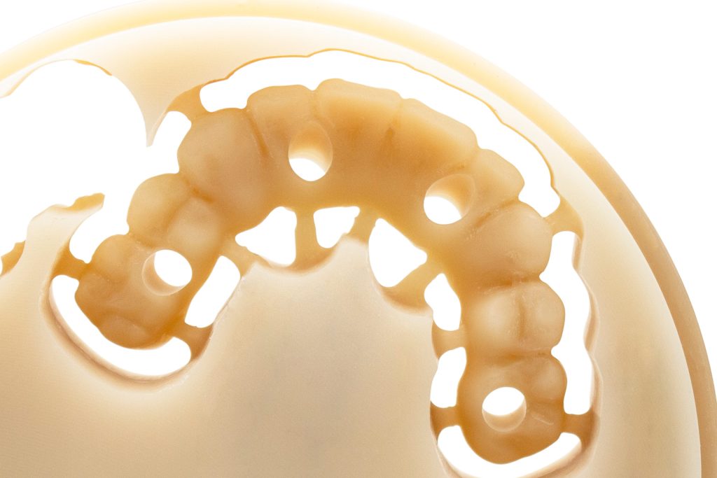 protesi provvisorie - sistemi innovativi dentali